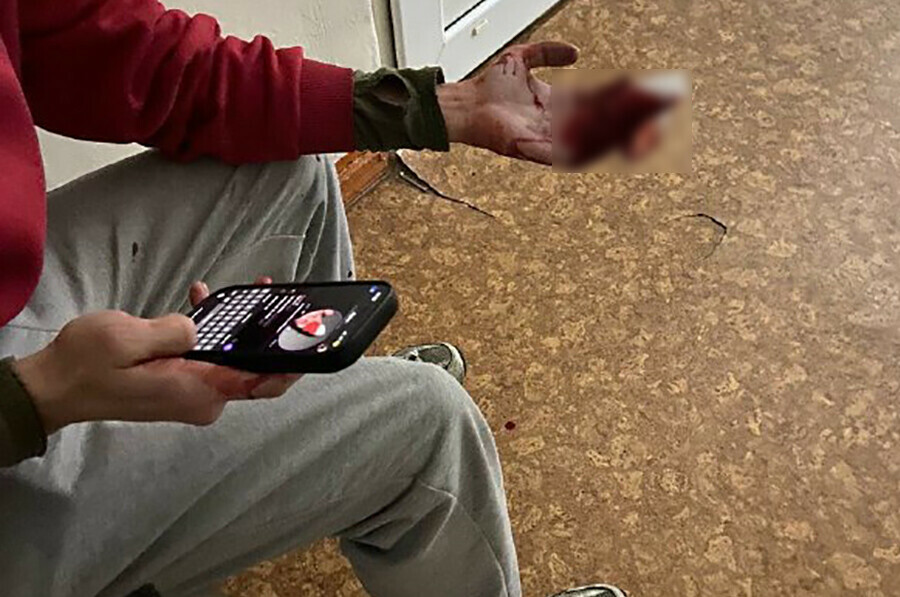 Военнослужащему изрезало руки осколками бутылки на горке Белогорска фото 18 видео