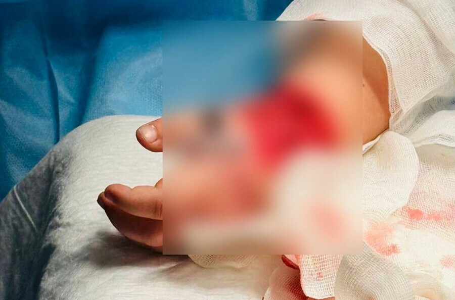 Врачи спасли руку маленькой девочки получившей ужасную травму на эскалаторе в торговом центре фото 18