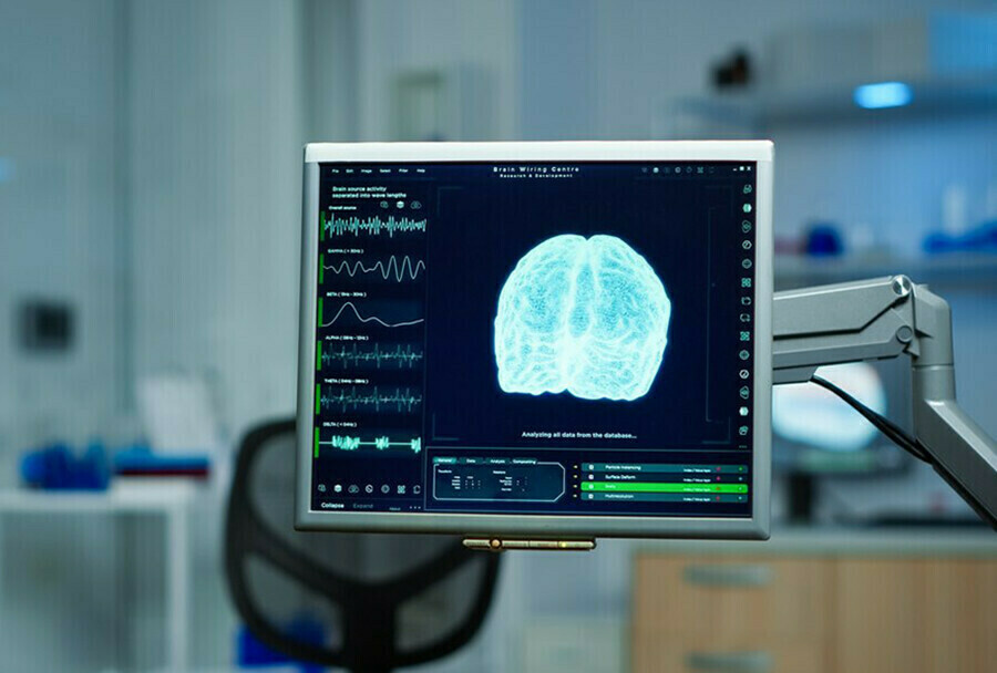 Ученые разглядели органические изменения в мозге после COVID19 которые снижают внимание и повышают усталость