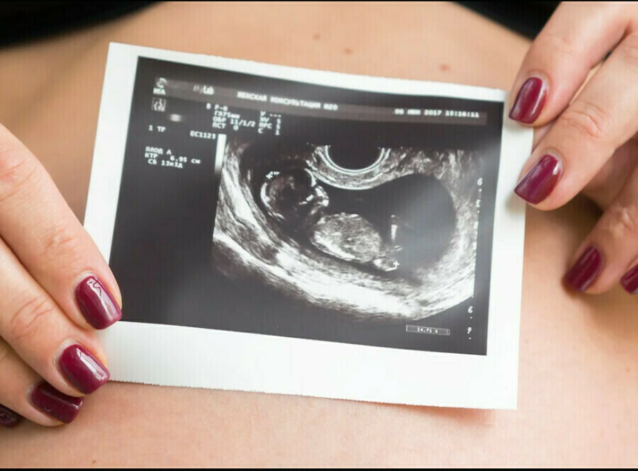 Одобрена выплата пособия по беременности для пяти тысяч студенток