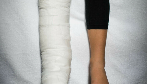 В Приамурье виновнику серьезного ДТП в котором подросток едва не потерял ногу смягчили приговор и вернули авто