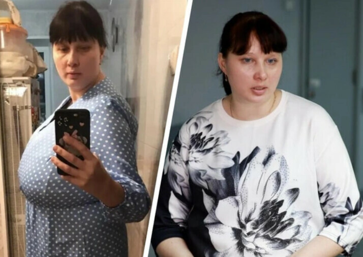 По четыре бюстгальтера носила одновременно Врачи вернули к нормальной жизни женщину с гигантской грудью