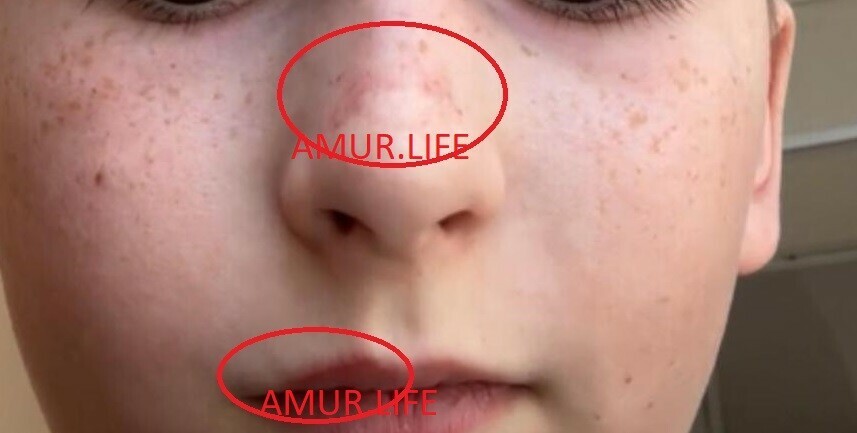 Сын кричал и плакал Мамочка мне больно в благовещенском кафе ребенку в лицо распылили перцовый баллончик