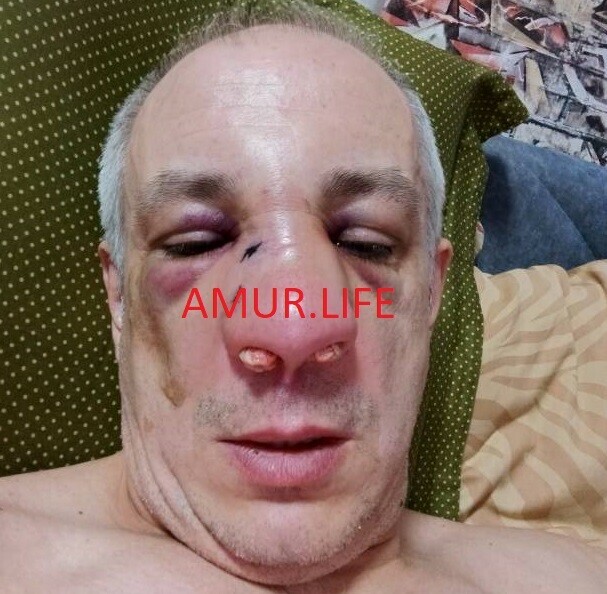 В Благовещенске таксист дважды за неделю подвергся нападению со стороны своих пассажиров