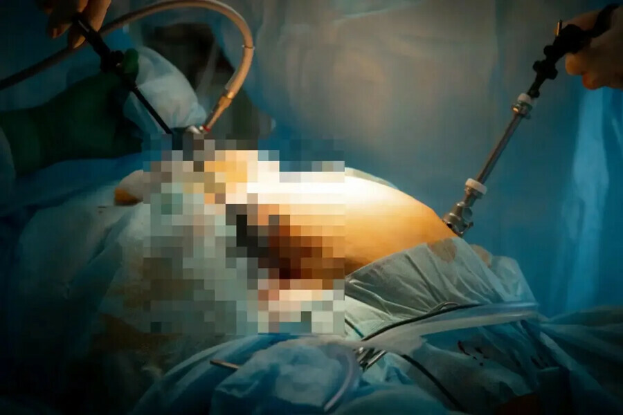 Слабонервным не смотреть гигантская опухоль выросла в теле жительницы Владивостока фото 18