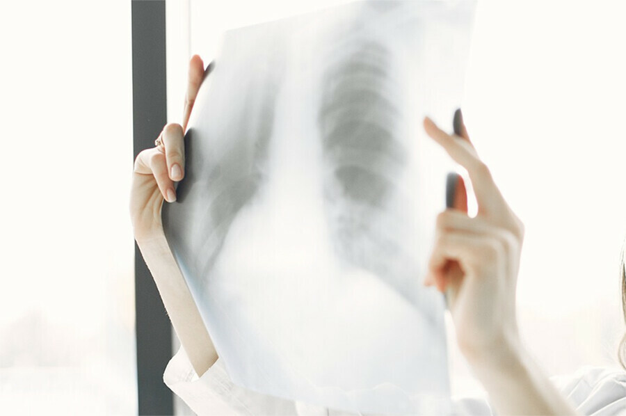 Стало известно от чего в Свободном умер рабочий ООО КипЭлектромонтаж