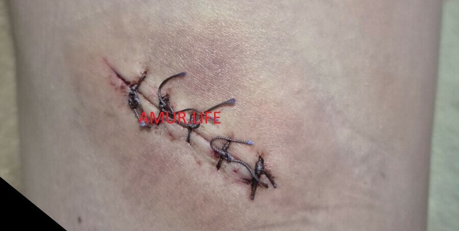 В полиции прокомментировали инцидент в амурской школе где ученица ранила одноклассника