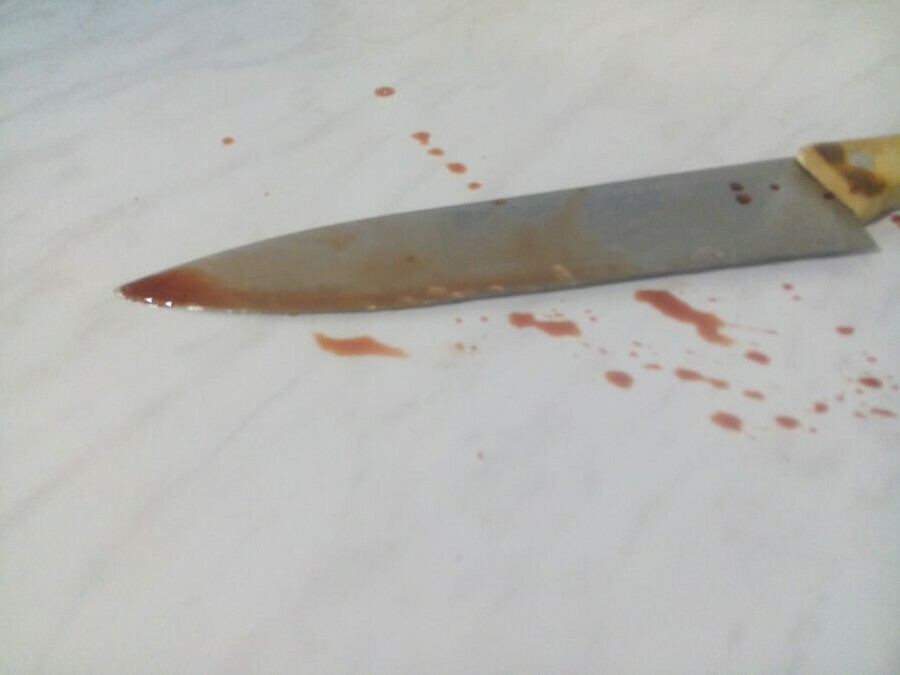 Машиниста экскаватора в Амурской области тяжело ранил коллега