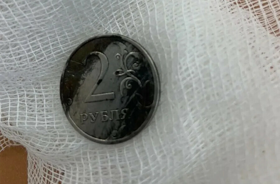 В Приморье врачи спасли 4летнего мальчика проглотившего опасный предмет