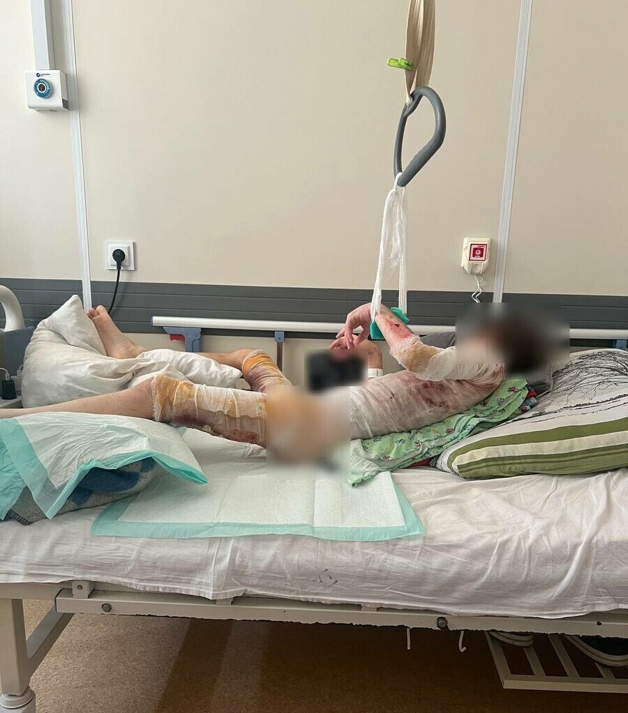 Проавоохранители проверили в каких условиях живут дети после инцидента с загоревшимся ребенком в Благовещенске