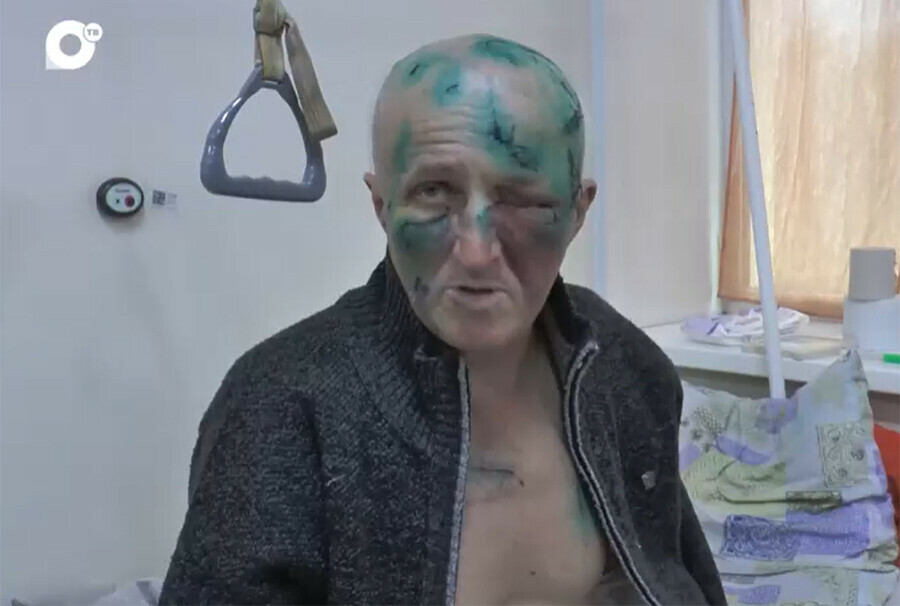 Медведь страшно исполосовал когтями рыбака в Приморье видео
